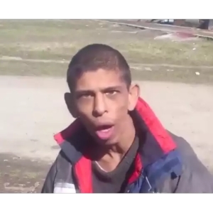 Surprised Expression