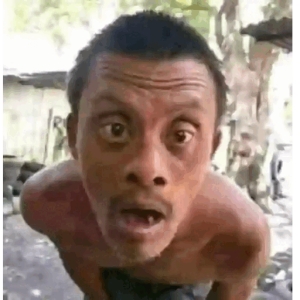 Surprised Expression_1