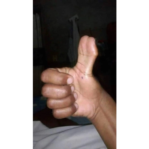Thumbs Up Gesture